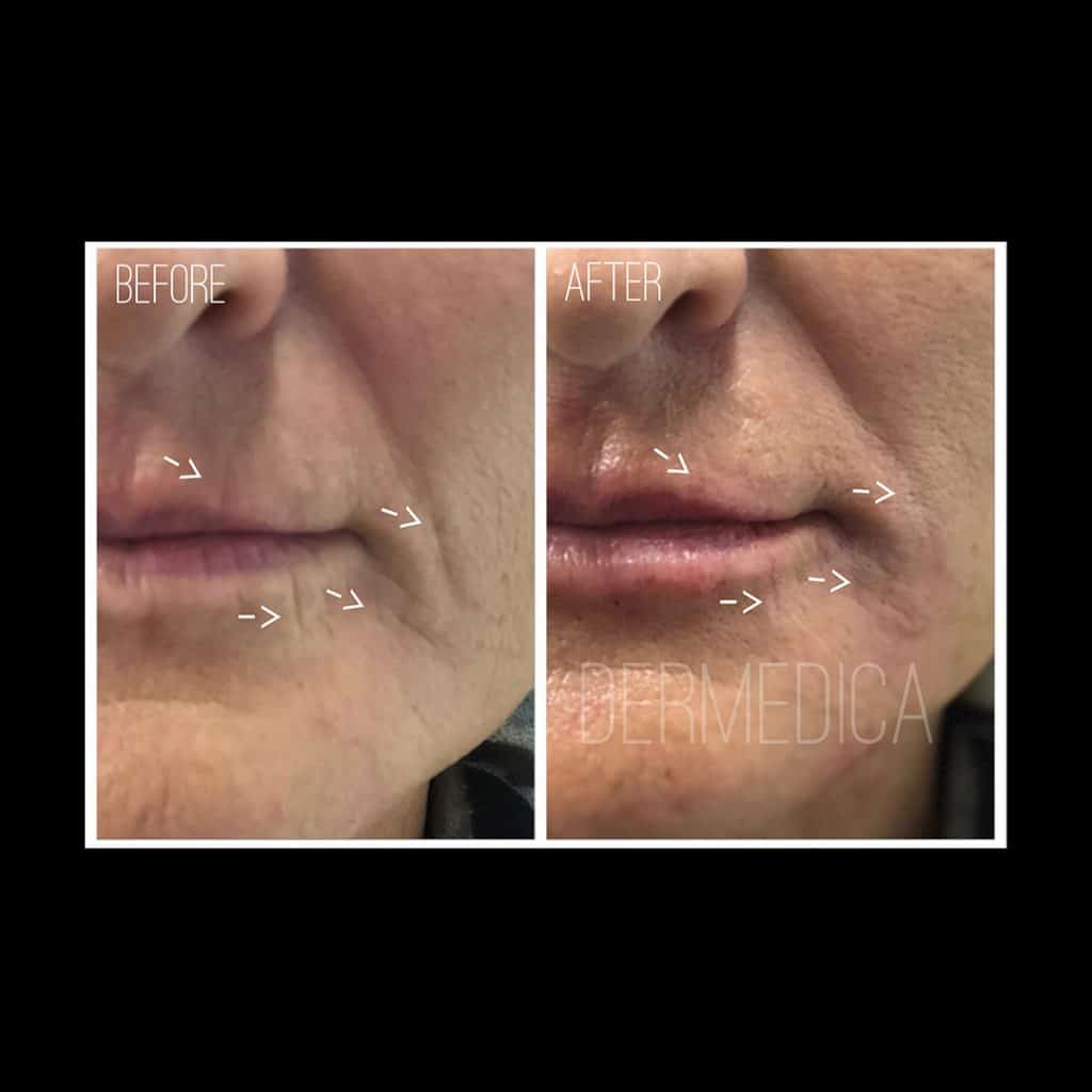 Cosmetic Treatment Face